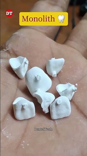 Monolith Crown 🦷|| Dental technician video| Zirconia design| Exocad| laboratory| anterior| posterior