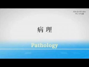 アキレス腱断裂／2分で分かる医療動画辞典 ミルメディカル