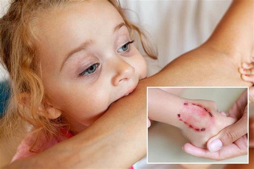 My toddler was bit at daycare — do I cofront the biter’s parents for an apology?