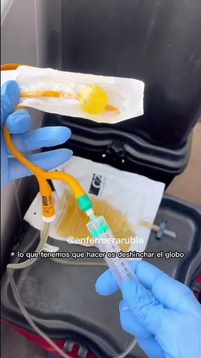 Urinary catheter removal. #nursing #nurse #urinarycatheter