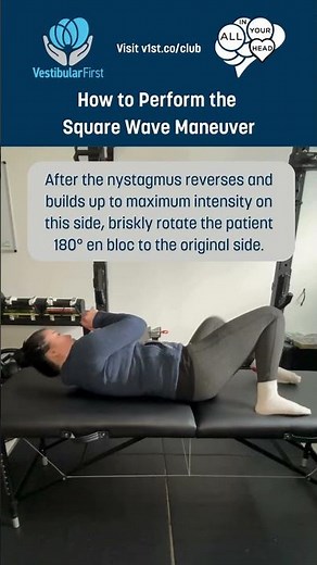 Square Wave maneuver for apogeotropic horizontal canal BPPV (Yacovino et al., 2021) #bppv
