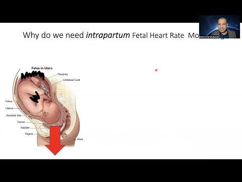 Physiological Interpretation of Cardiotocograph (CTG) : Paradigm Shift Part 1