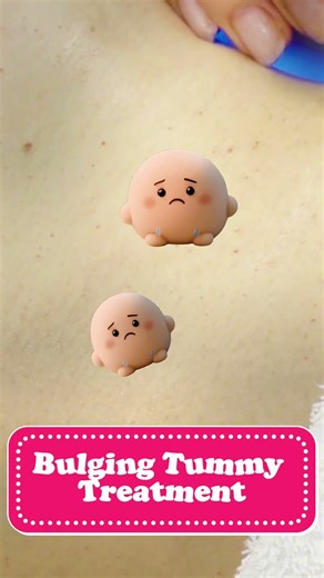 Reduce Tummy Bulge Instantly with ezSlim™ for FREE!💝