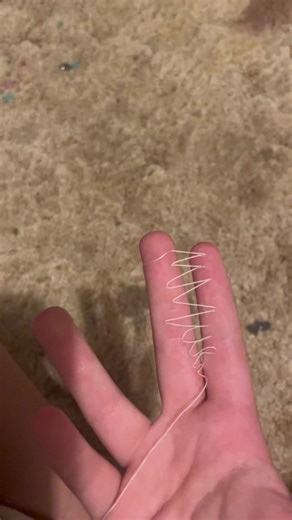 Cutesy Sewing Aftermath: Finger Tips Gone Wrong
