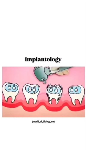 World of Biology on Instagram: "Implantology is a branch of Odontology that is intended for the treatment of edentulism with prosthetic rehabilitations supported or retained by dental implants. . - With Implantology, from unitary rehabilitations to large fixed or removable total rehabilitations are carried out. . - According to a study published in the Journal of Dental Research, a new stem cell implant technique allows a tooth to grow into the gum. . - Its objective is the implantation in the m