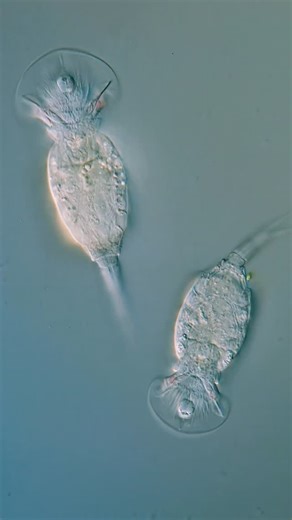 Jam's Germs on Instagram: "These are Squatinella, microscopic animals with very weird-looking bodies. They kind of remind me of tiny versions of street sweepers. . You are watching it sweep the underside of the coverslip on a slide, so you’re basically seeing its belly in focus. As it swims, the hair-like cilia sweep everything on the surface of the glass into its mouth, where you can also see its “jaw” working from time to time. . I was very curious about the origin of the name Squatinella but