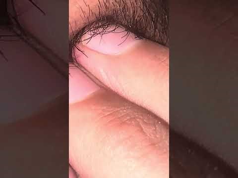 Perfect Beard Trim at Home | Step-by-Step Guide” hair removal