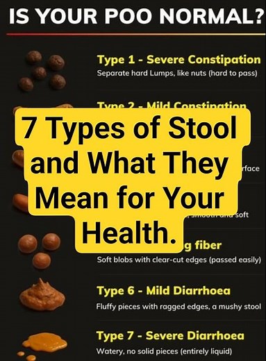 7 Types of Stool and What They Mean for Your Health. #chroniclyme #gargle