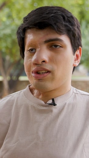 45K views · 281 reactions | My dad saved my life #reels #viral #borndifferent #truly #housefire #burnsurvivor #family | Born Different | Facebook