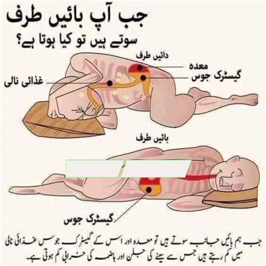 "Baen Taraf Sone Se Kya Hota Hai? 🤔Stomach Par Asar!" #sleepingpositions #LeftSideSleeping #ytshorts