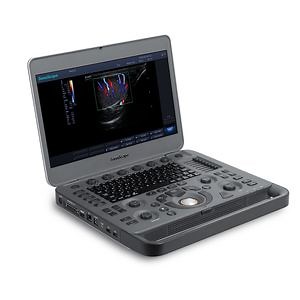 [Hot Item] Sonoscape X5 Medical Ultrasound Instruments Machine with Excellent Image Quality