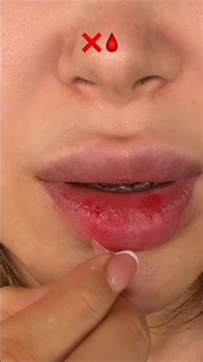 OMG❌Don't do this😭#makeup #skincare #lips #hack #beautytiips #viral #trend #music #love #shorts #fyp