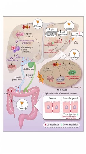 @biochemistry_nutrition_medlab on Instagram‎: "Mechanisms of ethanol-induced liver injury. 🧬Ethanol can upregulate lipid synthase & FA transporter activity to increase lipid synthesis & downregulate lipid transporters & β-oxidases to reduce lipid consumption, which eventually leads to lipid accumulation. 🧬ROS produced by ethanol oxidative metabolism triggers the release of proinflammatory cytokines & activates a variety of immune cells to release chemokines & cytokines, leading to immuno-infla