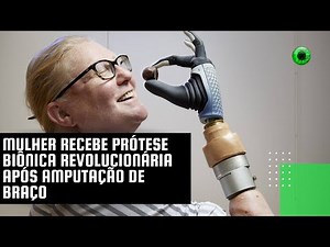 Mulher recebe prótese biônica revolucionária após amputação de braço