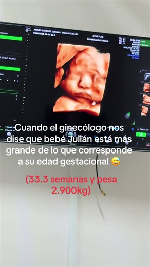 Estamos en la etapa donde nos toca ver a bebé Julián por partes por que está enorme y ya no se deja ver jaja
