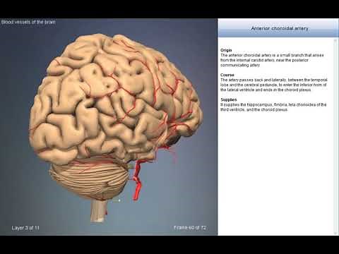 Anterior choroidal artery | Arteries of head and neck | 3D Human Anatomy | Organs