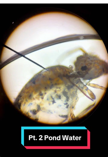 Pond Water Lab Results! #biology #biologyteacher #science #teachersoftiktok #pondwaterlab