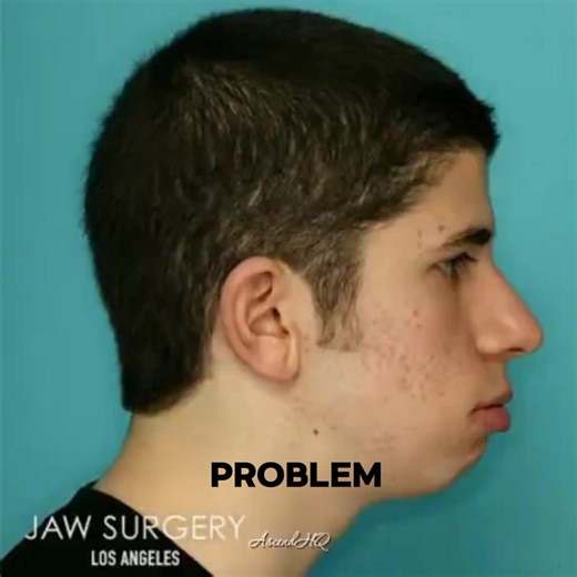 New Stock Available 🔥 Quality Price = Youth Prime Dalbo hadda – Jigjiga Delivery 🚚 #jigjiga_somali_galbeed♥️🇸🇴🇬🇶#primeyouth#onlineshopping