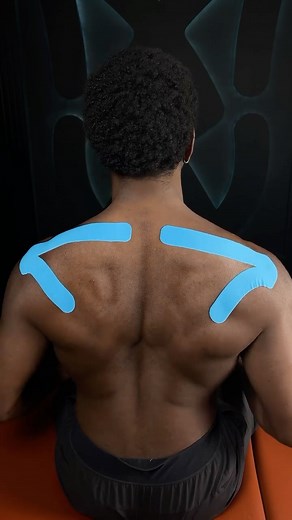 Spidertech Kinesiology Tape on Instagram: "Taping For Increased Shoulder Proprioception. Ever feel like your shoulder isn’t moving quite right—especially after an injury or long periods of inactivity? That’s likely a proprioception issue—your body’s ability to sense movement, position, and stability. When proprioception is compromised, your shoulder struggles to react properly, increasing the risk of poor mechanics, instability, and even re-injury. 🔎 Why Shoulder Proprioception Matters: 🔹 Post