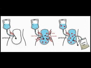 Renal 4:/4 Dialysis Masterclass: Indications, Heparin Antidote, and CRRT NCLEX
