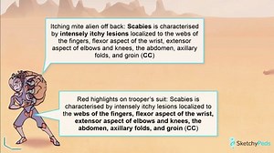 Scabies & Lice SOAP - Free Sketchy Medical Lesson