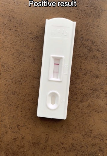 H.pylori Antibody Test Results Explained