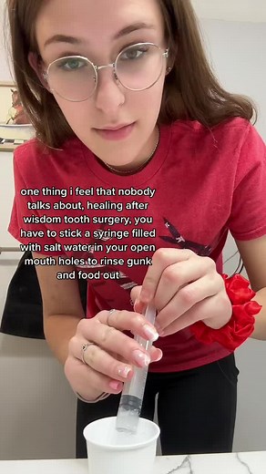 How to Clean Wisdom Teeth Holes: Syringe Techniques Explained
