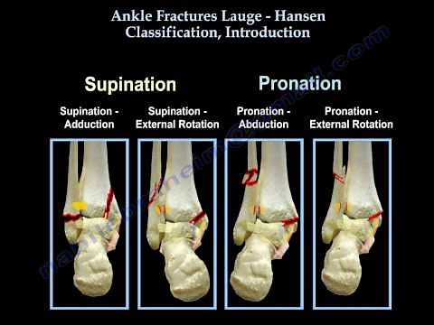 Ankle Fractures Lauge Hansen, Introduction - Everything You Need To Know - Dr. Nabil Ebraheim