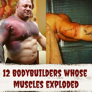 12 Bodybuilders Whose Muscles Exploded | Fit Dudes