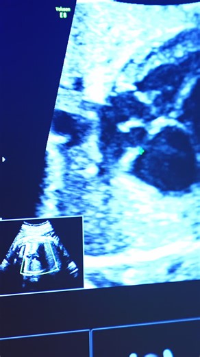 Blue screen of an ultrasound apparatus showing the abdomen of a pregnant woman. Doctor checking the pregnancy condition. Vertical video | Premium Stock Video Footage