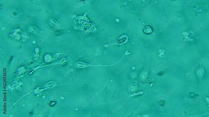 Human Sperm Seen at 400x Magnification in Phase Contrast fluorescence Microscope