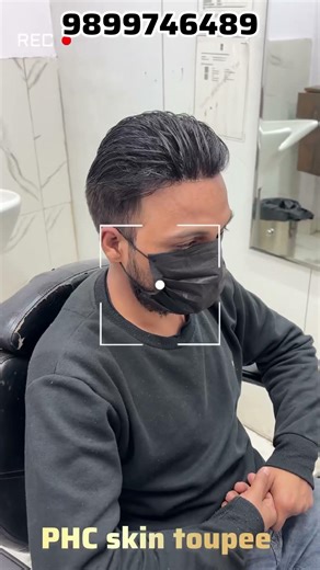 Most Premium Skin Base Hair Patch System | 100% Natural Look #hairreplacement #hairsystem #shorts