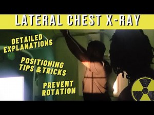 How get a TRUE Lateral Chest X-ray (Prevent rotation) || Ask The Rad Tech