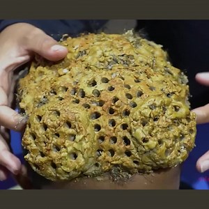 OMG! Removal Worm Flakes On Scalp!! Satisfying Psoriasis Dandruff #395 Part 1 | Help remove ticks