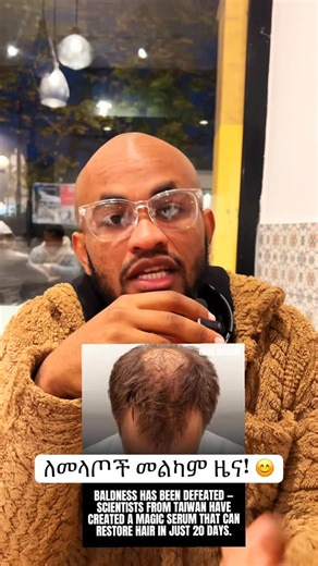 Cure for baldness! Taiwan Discover serum that cure baldness in just 20 days! | Yohannes Mekonene