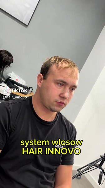 Czym jest system włosów? Przeczytaj opis ⬇️ System uzupełnień włosów to niechirurgiczna alternatywa do przeszczepu włosów. System włosów stworzony jest z naturalnych ludzkich włosów, które Połączone są z bardzo delikatną siatką. Ta siatka jest zintegrowaną ze skórą głowy za pomocą specjalnych taśm. Dzięki temu włosy wyglądają w stu procentach naturalnie, można prowadzić w nich aktywny tryb życia, uprawiać sport itp. Normalnie brać prysznic itp. Na codzień nie ma żadnych większych ograniczeń. Taś