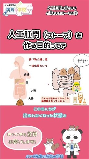 What is the purpose of creating an artificial anus (stoma)?