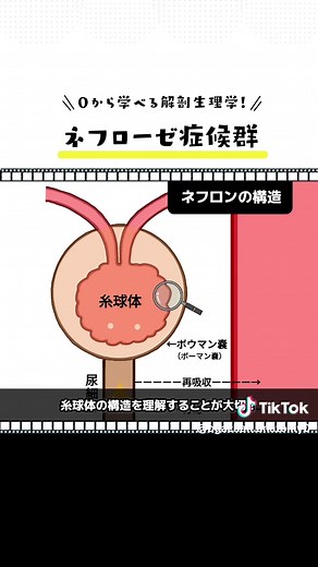 【ネフローゼ症候群の仕組み】 #医療学生 #解剖生理学 #インストラクター #セラピスト #マッサージ #看護 #看護学生 #整体 #解剖学 #解剖学の勉強 #過去問 #ネフローゼ症候群 #腎臓 #腎不全
