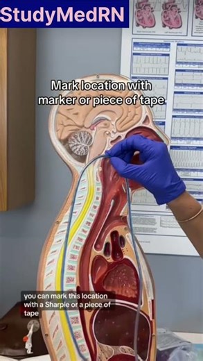 Nasogastric tube insertion