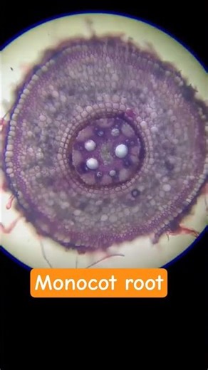 Monocot root under microscope