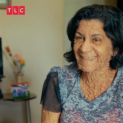 Her body is covered in thousands of tumours due to a genetic condition 😦😢 #BodyBizarre | TLC UK