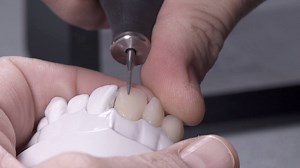 12K views · 119 reactions | Check out our latest Tech Tip using Celtra Press and Celtra Ceram to create an amazing veneer. | Dentsply Sirona Lab | Facebook