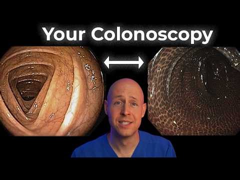 What Your Colonoscopy Findings Say About Your Gut Health