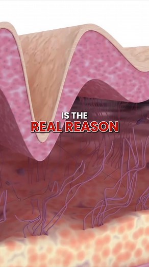 917 reactions · 59 shares | Tired of feeling like nothing is helping fix crepey skin? Harvard dermatologist Dr. J explains how to use moisturizing properly to help achieve the youthful and glowing skin. | Miami MD | Facebook