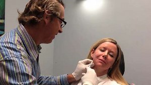 Artefill Volumization of the Cheeks