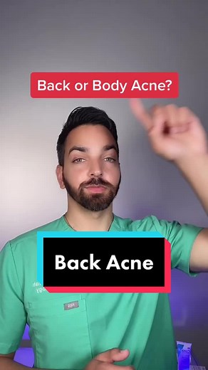 Back Acne Treatment Tips