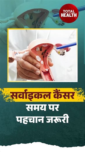 DD News on Instagram: "Cervical cancer is a common cancer among women and is mostly caused by Human Papillomavirus (HPV) infection. It develops slowly and often shows no early symptoms. Early detection through health awareness and regular screening is crucial. HPV infection can be prevented. In India, many women are affected, even though cervical cancer is largely preventable and its risk can be reduced significantly. Watch full show: https://www.youtube.com/watch?v=D2l_RUShxIk #CervicalCancer #