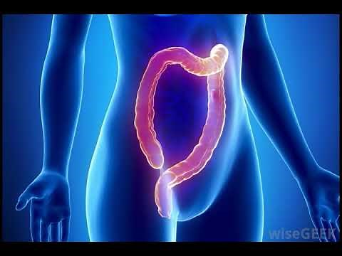 What is a Rectal Tube