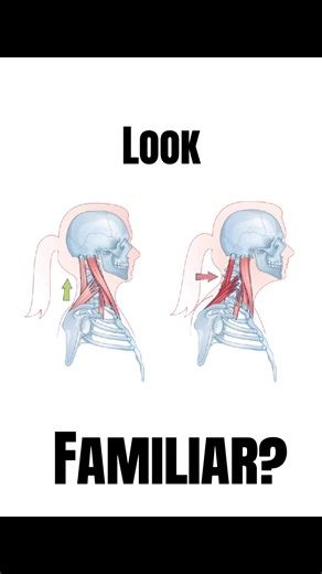 Understanding the Maxilla and Zygoma Basics