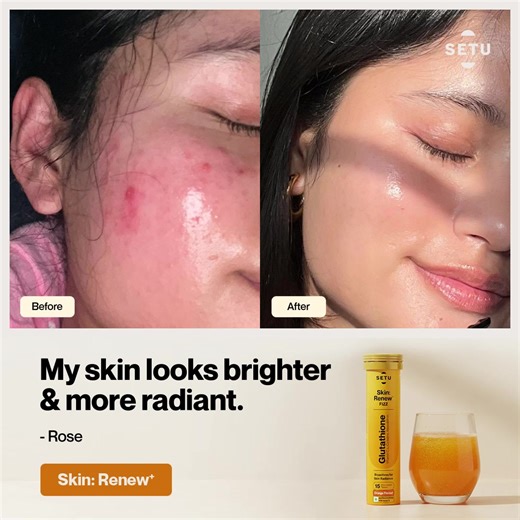 Your glow isn’t luck — it’s consistency. These real Setu users saw brighter skin, reduced dark spots & smoother texture… just by adding one daily Skin Renew fizz. If they can transform their skin, so can you. | Setu Nutrition